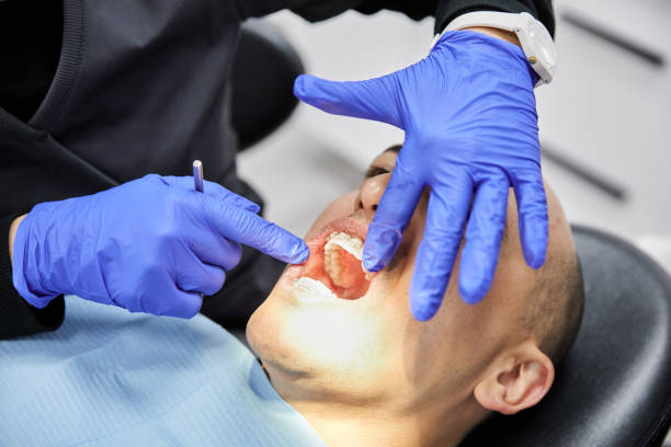 Best Emergency Dental Extractions in Lancaster, TX